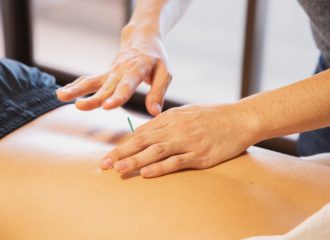 L’essentiel à savoir sur l’acupuncture