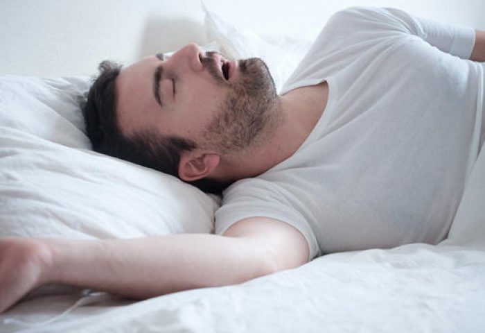 Apnée du sommeil : pourquoi faire une polysomnographie et comment ?